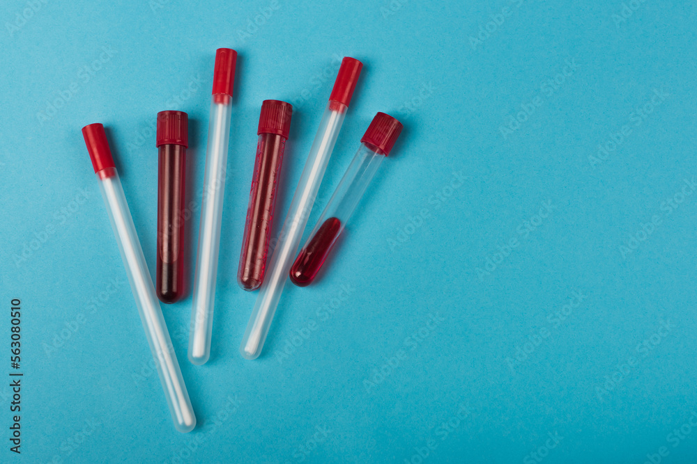 Test tubes with blood samples near cotton swabs on blue background. Test tubes with blood samples near cotton swabs on blue background.