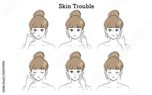 お肌のトラブルのイラストセット（おだんごヘアの女性）