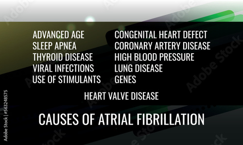 Causes of atrial fibrillation. Vector illustration for medical journal or brochure.