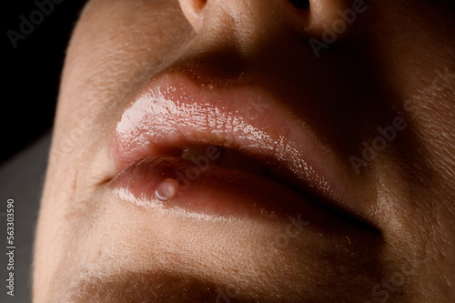 Close-up of beautiful female lips at procedure of cosmetic botox injection.