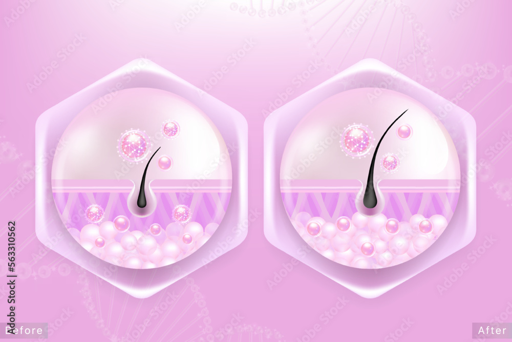 Hyaluronic acid before and after hair and skin solutions ad. pink collagen serum drop into skin