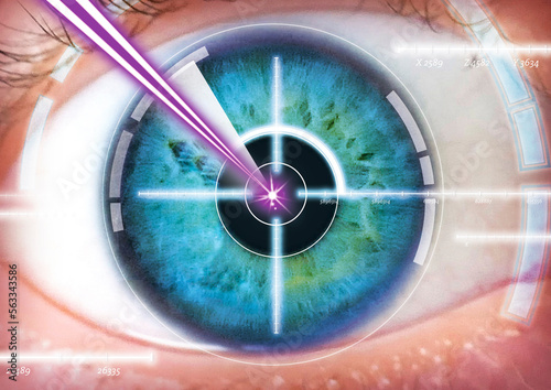 eye laser operation, pupil