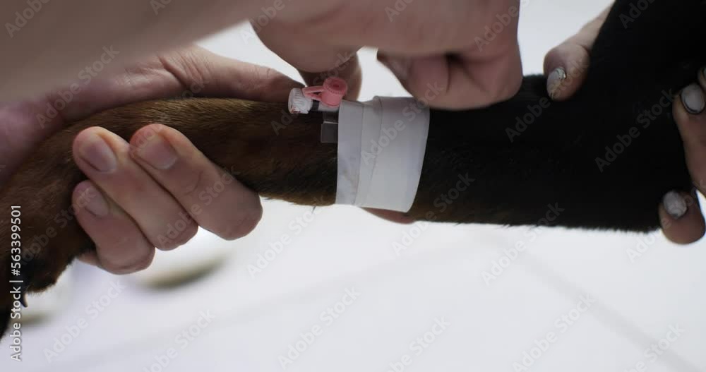 Stockvideo The doctor bandages an intravenous catheter installed on the