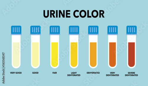 Urine color chart and meaning infographic in flat design.