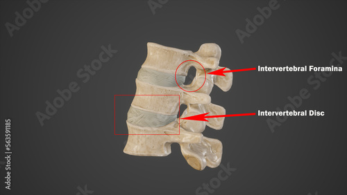 Medical Illustration of Intervertebral Foramina and Intervertebral Disc photo