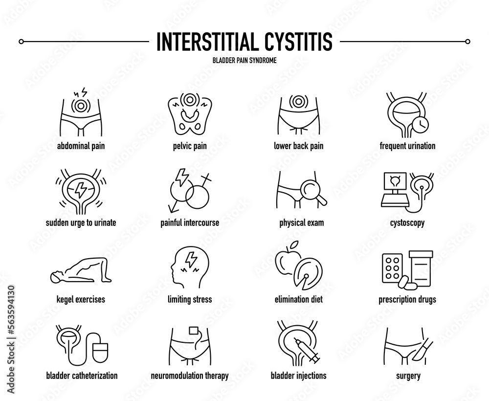 Interstitial Cystitis symptoms, diagnostic and treatment vector icon ...