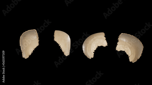 Right Parietal Bone-Multiple Views photo