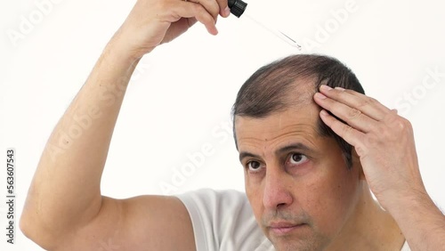 Young man hair treatment. Argan oil healthy massage.Male person who applies a product to stop hair loss. Liquid cosmetic dropper therapy.