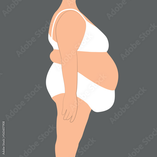 Side view of obese female body with large fat belly