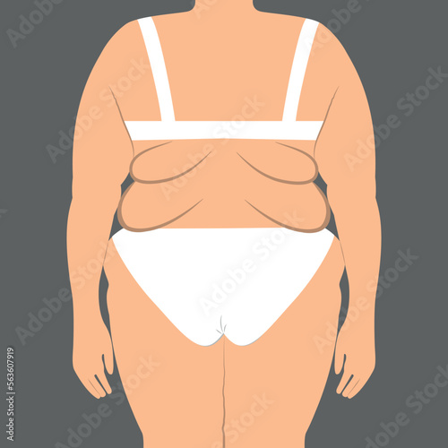 Back view of obese female body