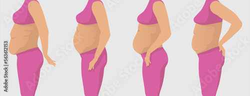 Vector illustration of fat women with different types of belly in pink sportswear, side view