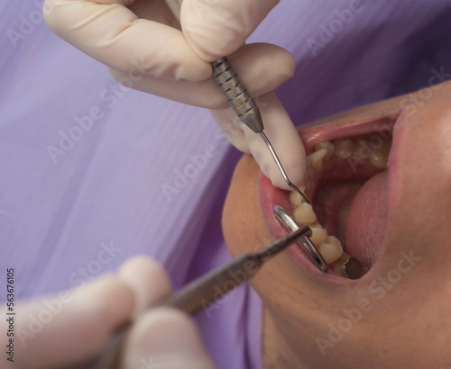 dental checkup of a middle-aged woman