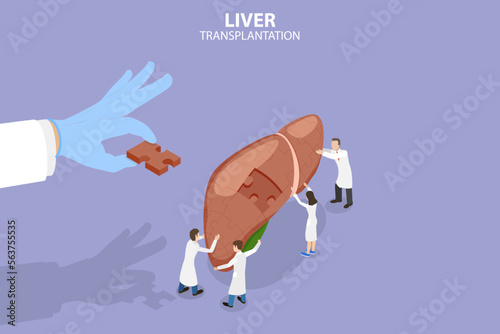 3D Isometric Flat Vector Conceptual Illustration of Liver Transplantation, Donation Organs