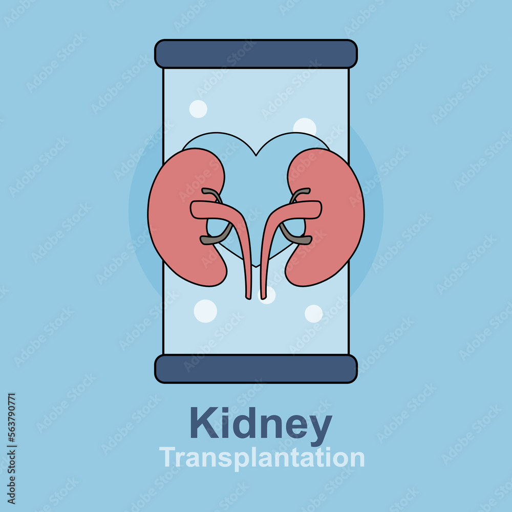 kidney transplantation,Cleansing and transfusion of blood through a