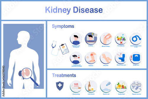 Infographics of various symptoms of kidney disease and treatments. Headache, insomnia, erectile dysfunction in males, edema and weight loss. Health care concept.vector illustration.flat style.