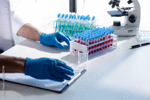 Lab assistant, a medical scientist, a chemistry researcher holds a glass tube through the blood sample, does a chemical experiment and examines a patient's blood sample. Medicine and research concept.
