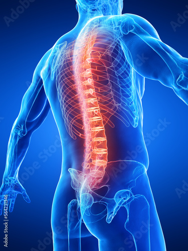 3D Rendered Medical Illustration of a man's spine