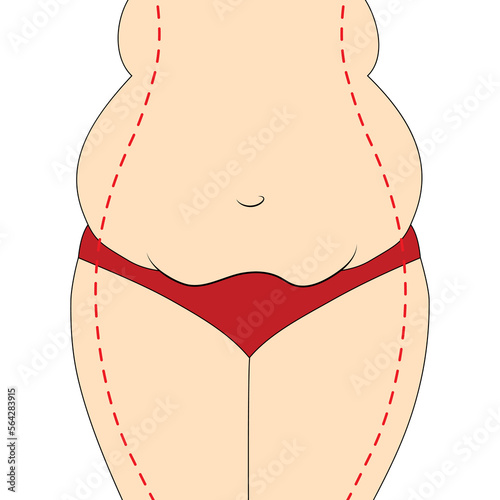 Vector illustration of woman lower body silhouette with curvy hips overweight in panties. Weight loss healthy diet plastic surgery body positive self-love concept