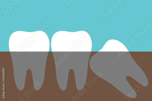 Wisdom tooth flat icon in minimalistic style. Impacted tooth