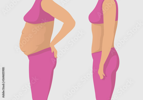Vector illustration of a woman's body with a fat belly and a woman's body with a slender beautiful figure, before and after exercise for weight loss