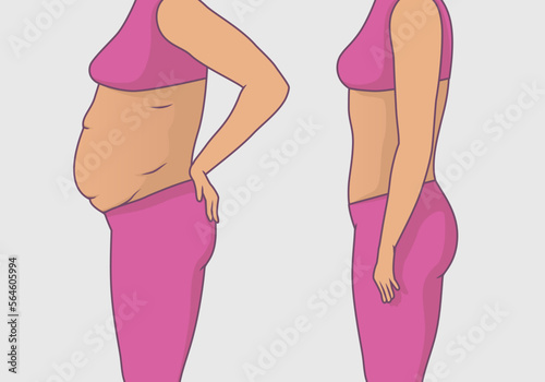 Vector illustration of a woman's body with a fat belly and a woman's body with a slender beautiful figure with contour, before and after exercise for weight loss