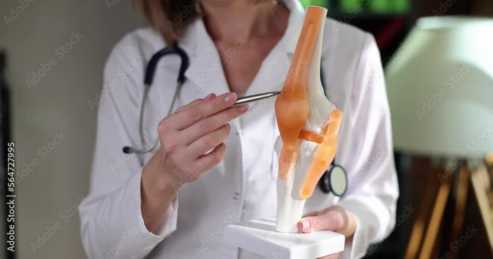 Doctor showing with pen on artificial knee joint of human closeup 4k movie slow motion Doctor showing with pen on artificial knee joint of human closeup 4k movie slow motion