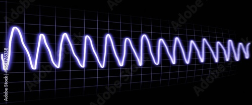 purple ecg image shows ventricular tachycardia illustration