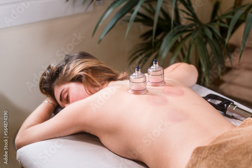 Relaxed woman during cupping traditional therapy  photo