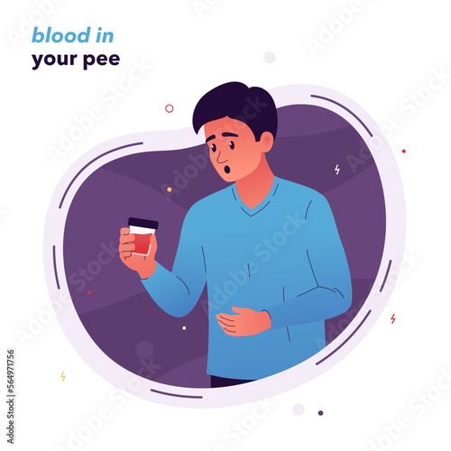 Vector illustration of an excited man holding a jar of urine in his right hand. Blood in the urine is a symptom of kidney disease, viral infections. Illustration for medical articles, posters, stands.