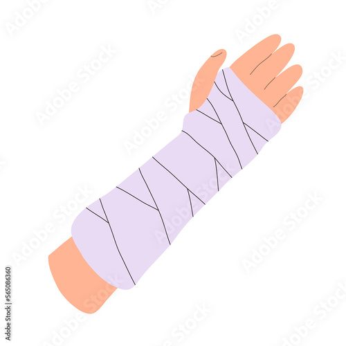 Broken arm. Gypsum bandage. Medical care, treatment and rehabilitation. Help with trauma. Flat vector illustration isolated on white background photo