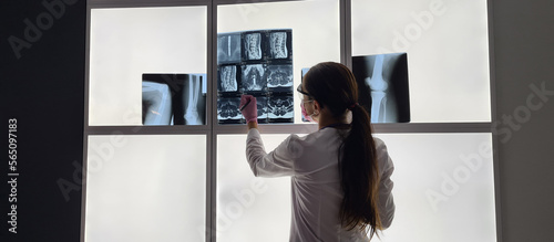 Radiologist checks x-ray image on light box photo