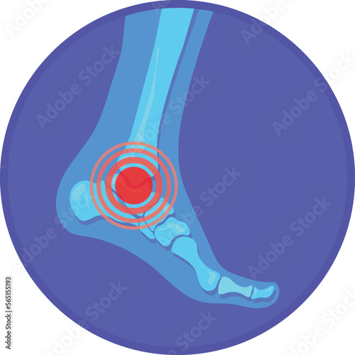 Anckle pain icon. Red spot in foot bone