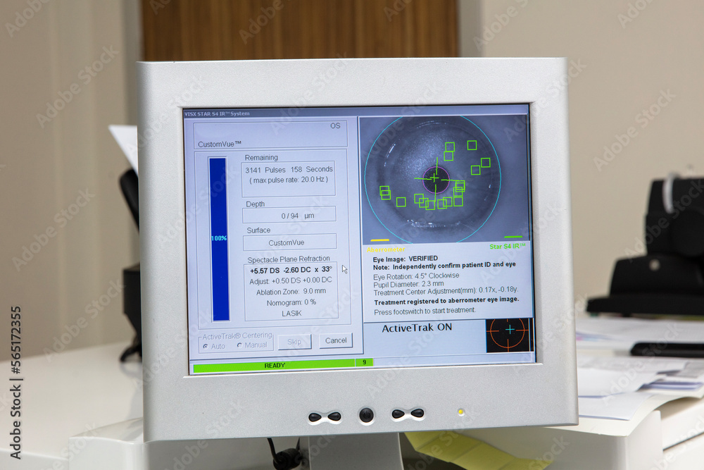 Eye surgery process, treatment of cataract and diopter correction