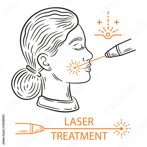Laser face skin treatment, anti-aging beauty procedure, facial hair removal outline icon. Medical cleaning acne, rejuvenation therapy. Woman with light ray cosmetology device. Body care hygiene vector