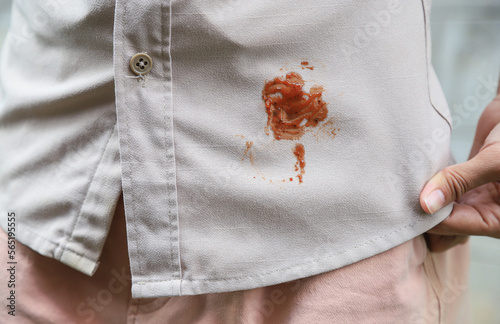 Hand showing dirty sauce stain on shirt from accident in eating in daily life. selective focus. stain for cleaning