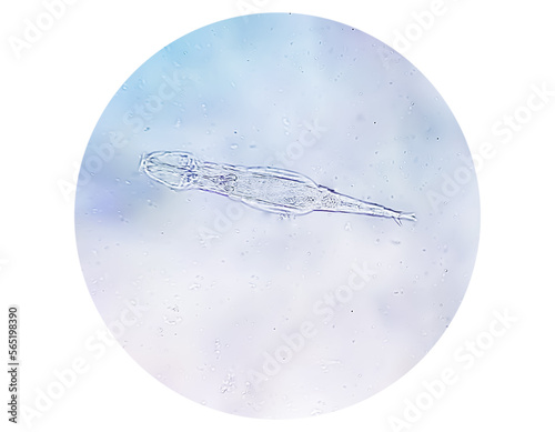 Schistosoma Haematobium Parasite in human urine specimen under microscope. Urinary parasite