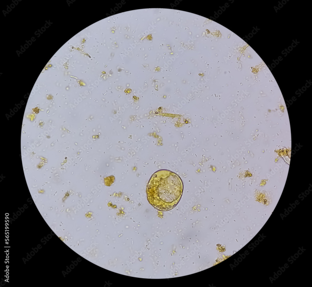 Foto de Microscopic examination of Stool showing Blastocystis hominis