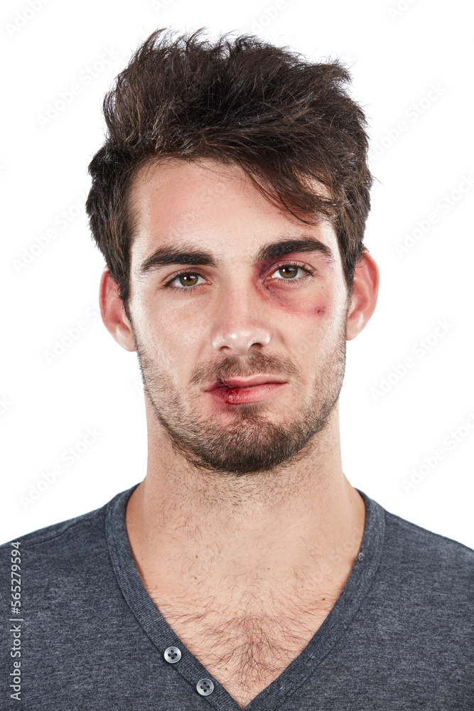 Portrait, facial and injury by man in studio for black eye, accident or fight on white background. Face, danger and domestic violence victim with wound, blood and injured while standing isolated Portrait, facial and injury by man in studio for black eye, accident or fight on white background. Face, danger and domestic violence victim with wound, blood and injured while standing isolated