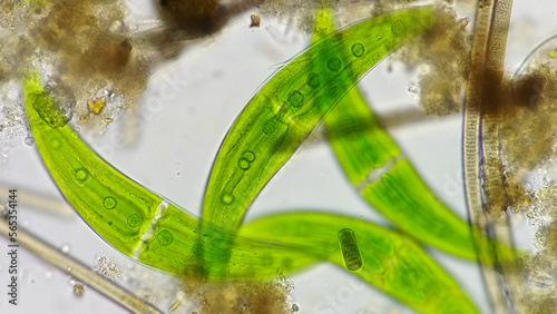 Closterium and their substrate. Live cell. Selective focus photo