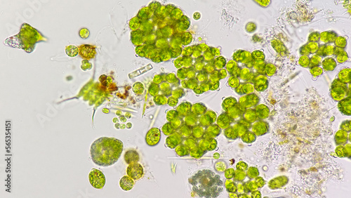 Coleastrum, Scenedesmus, Euglena, and another green algae. 400x magnification with selective focus