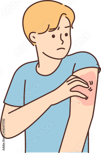 Unhealthy man scratching arm suffer from pox