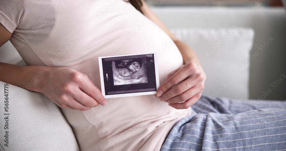 Pregnant Woman With Ultrasound Image Pregnant Woman With Ultrasound Image