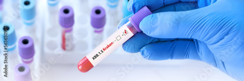 Doctor holding a test blood sample tube positive with Covid-19 XBB.1.5 Kraken Variant test. Banner