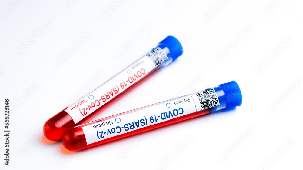 flasks with blood tests for monkey pox virus positive and negative, mpox flasks with blood tests for monkey pox virus positive and negative, mpox
