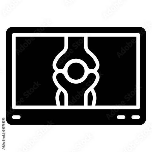 x-ray bone illustration