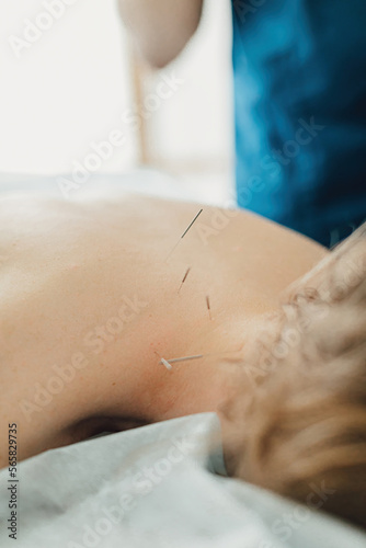 Woman stabbed in the back with needle in bright acupuncture clinic