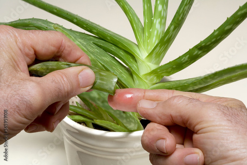 Putting Aloe Vera on a minor burn. photo