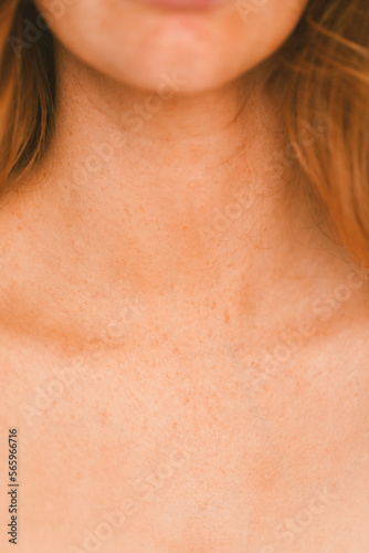 Upclose of a woman's neck and collarbones with freckles on skin
