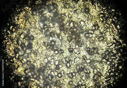 An orange seed peel under light microscope