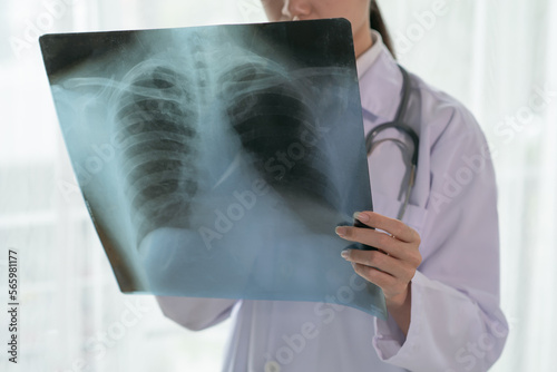 Female radiology doctor examining at x ray film of patient at hospital room, lung radiography concept